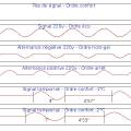 signal_5.jpg